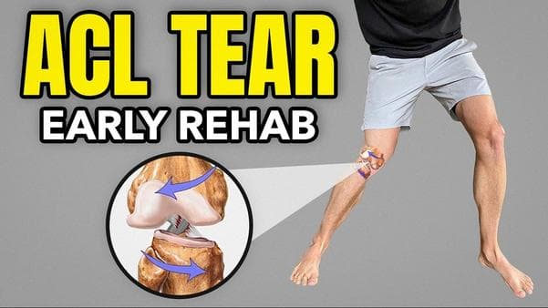 𦡠ACL Injury Recovery Plan β Step-by-Step Guide
π¨...